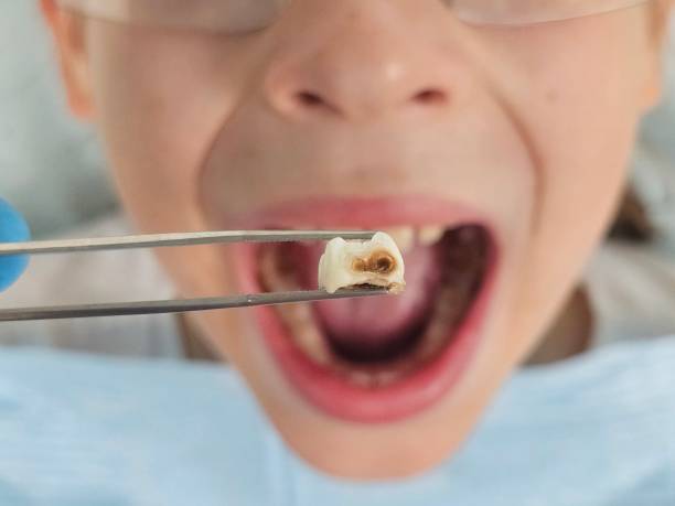 Best Broken or Chipped Tooth Repair in Pharr, TX
